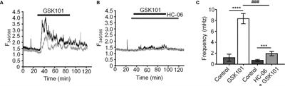 Emergent Temporal Signaling in Human Trabecular Meshwork Cells: Role of TRPV4-TRPM4 Interactions